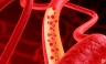 Искусственно созданные кровеносные сосуды. Новая перспектива в лечении инсультов и инфарктов