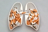 Ученые: легкие хронических курильщиков могут использоваться для пересадки