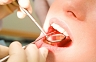 Новое в методах  ухода за зубными протезами