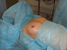 Две шведки узнали себя в видеороликах, демонстрирующих подробности операции по увеличению груди