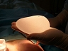Как правильно подобрать размер имплантатов груди